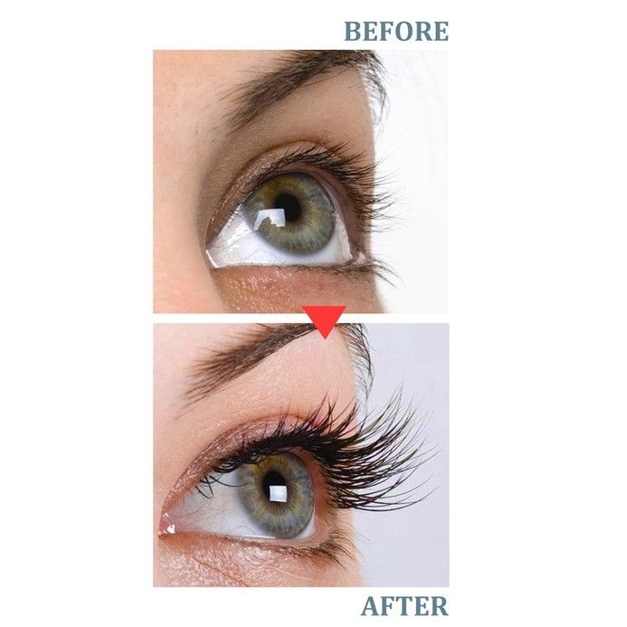 Natbea Eyelash Growth Serum (Category: Vision Care) located in Manila. Submitted by larascollection0920 (Listing ID 1226941890, Image 2). Description: LENGTHEN AND STRENGTHEN your eyelashes and brows to achieve alluring eyes naturally. Our nourishing eyelash growth serum promotes new eyelash growth and fortifies existing hairs for bold, dramatic-looking eyes in as little as 2 weeks. This advanced formula eyelash growing serum provides a magical b