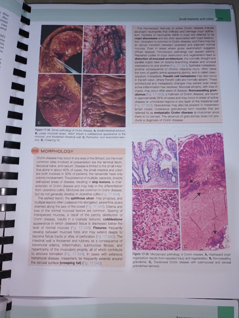 Robbins and cotran pathologic basis of disease ninth edition hobbies