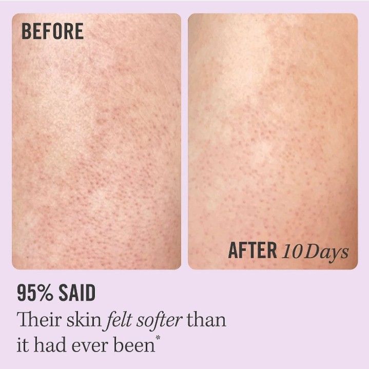 FIRST AID BEAUTY KP bump eraser body scrub 28.3g, Beauty & Personal