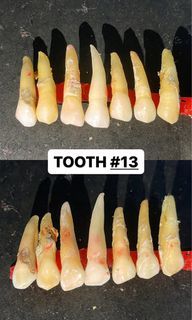 NATURAL TOOTH