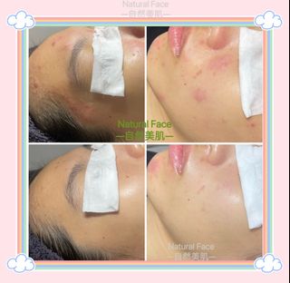（分類：）位於 。 由 natural_face 提交（商品編號 1182078822，圖片 1）。簡介： 。