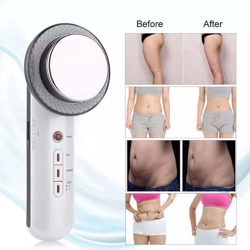Ultrasonic fat burner before and after 2025
