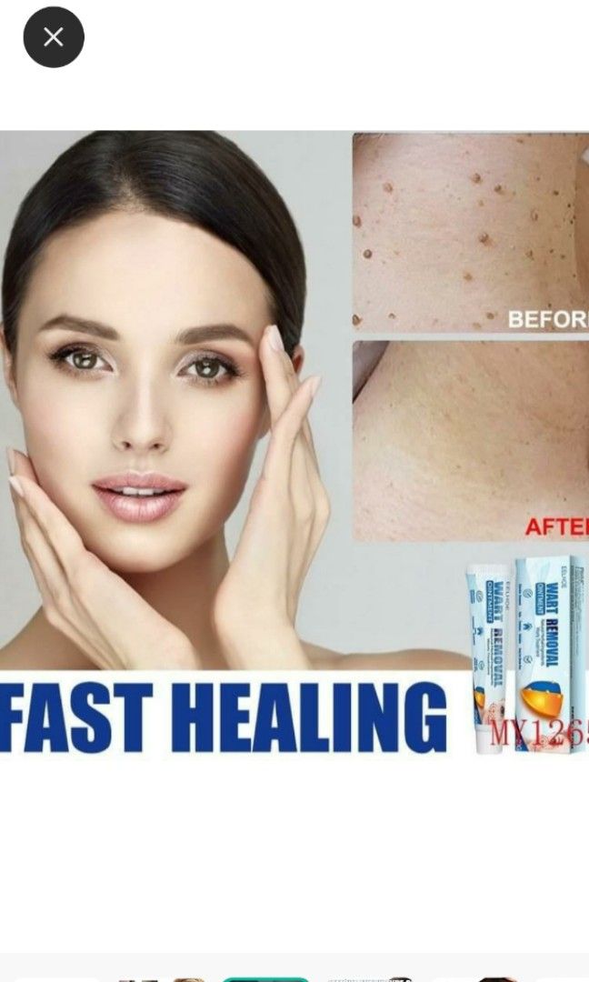 Warts removal ointment, 相機攝影, 空拍機在旋轉拍賣