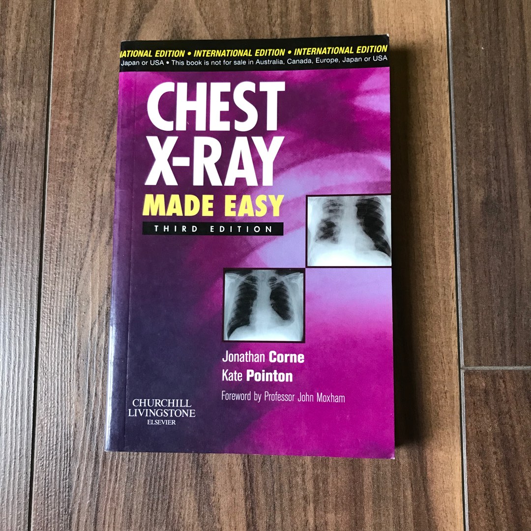 CHEST XRAY MADE EASY (THIRD EDITION), Hobbies & Toys, Books
