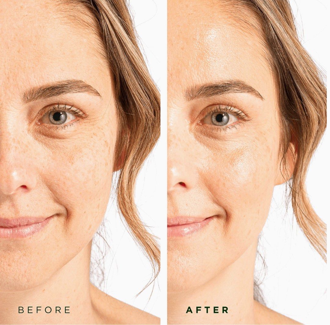 Tree of life hyaluronic acid serum on Carousell