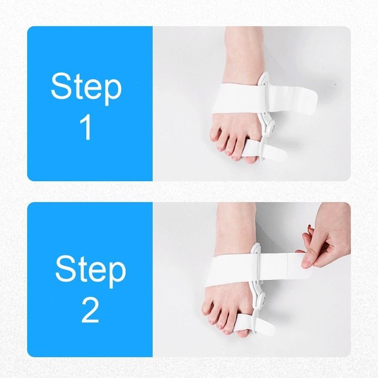 Big Toe Day Night Bunion Splint Big Toe Corrector, Health & Nutrition, Braces, Support