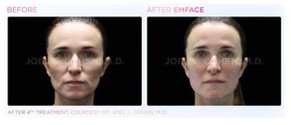 Face Treatment Collection item 1