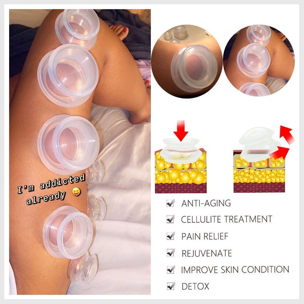 6 Sizes Cupping Therapy Set-Professional Cupping Therapy Studio and ...