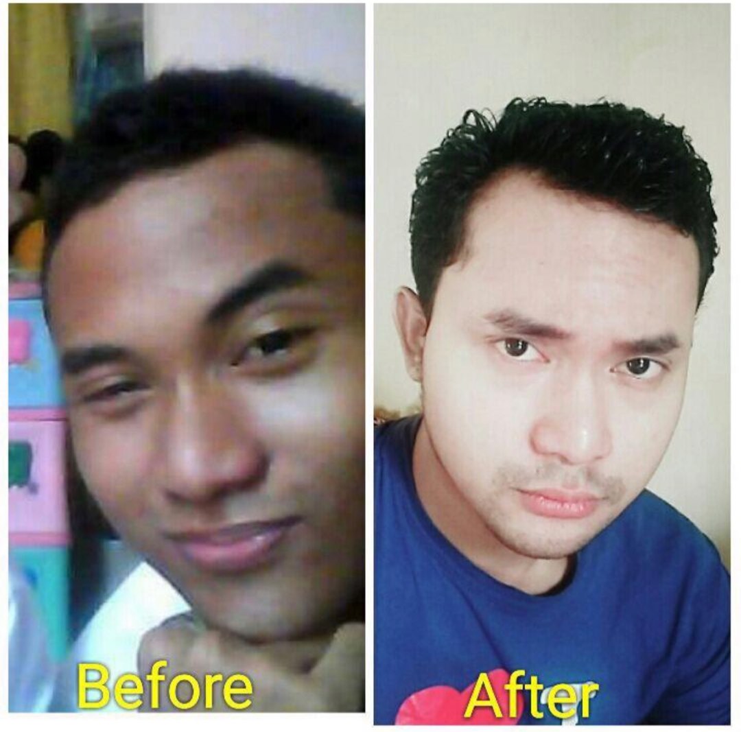 whitening cream for extra whitening skin, Beauty & Personal Care, Face