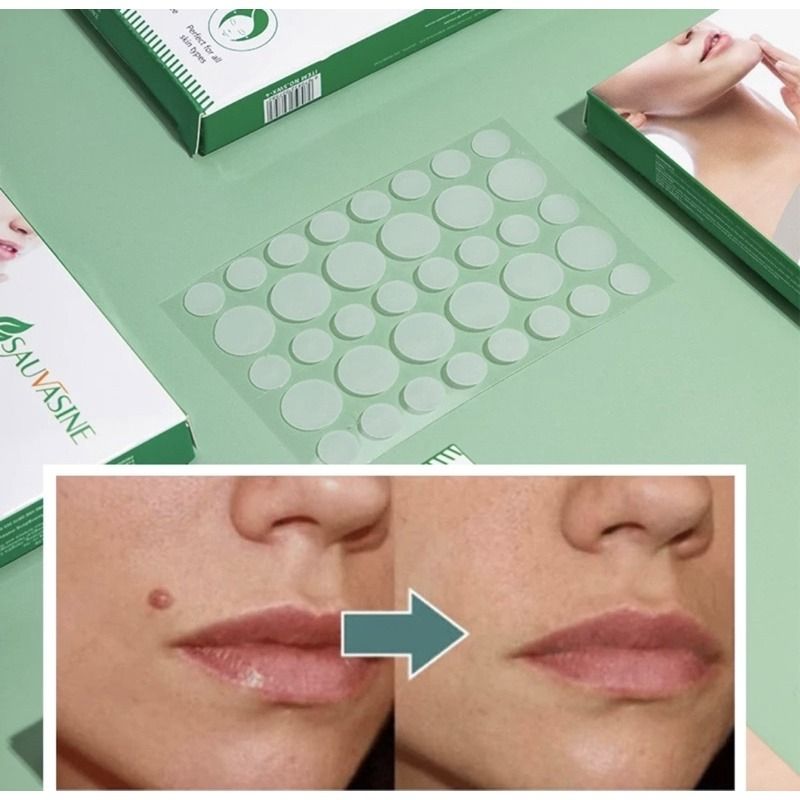 Skin tags liquid removal patches, Beauty & Personal Care, Face, Face ...