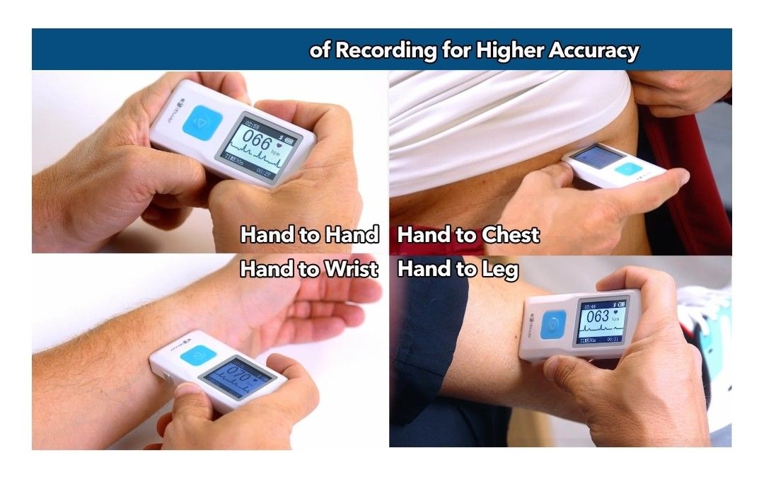 EMAY Portable ECG Monitor (included free delivery), Health & Nutrition