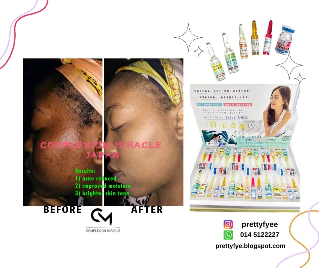 Complexion Miracle Whitening drip, Beauty & Personal Care, Bath & Body