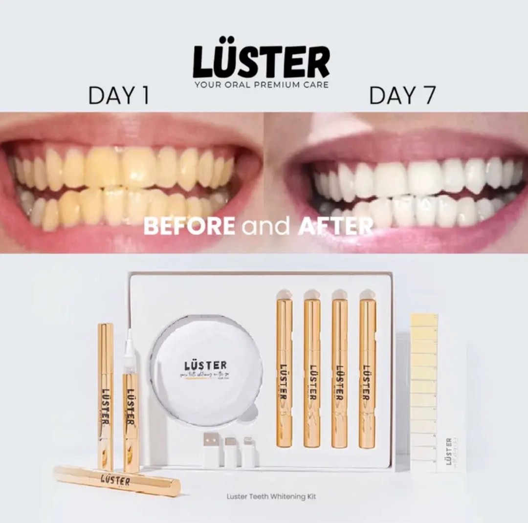 LUSTER TEETH WHITENING on Carousell