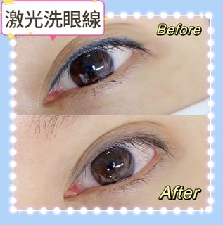 （分類：）位於 。 由 belle_debeaute 提交（商品編號 1238351904，圖片 1）。簡介： 。