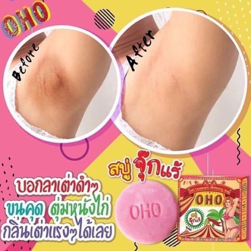 OHO Underarm Whitening Soap Specially Clean Dark Chicken Skin Rashes