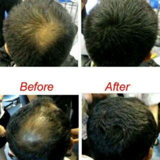 Best 5 stars Regrow your hair fiber toppik Caboki