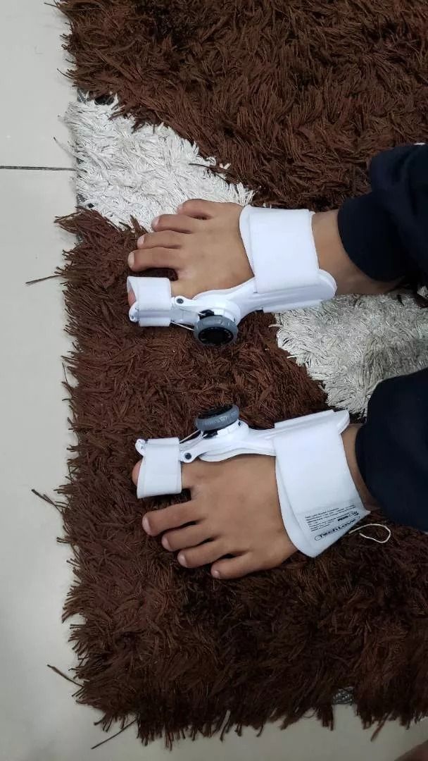 Pediconfort hallux valgus outlet