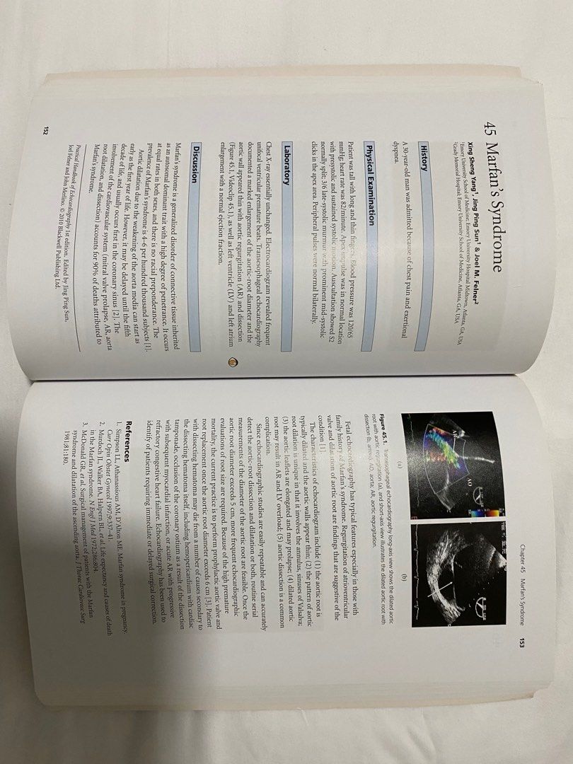 Practical Handbook of Echocardiography, Hobbies & Toys, Books ...