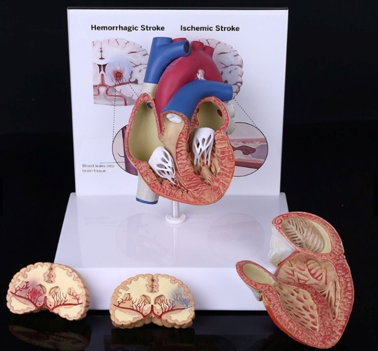 Human Heart Model Anatomy, Health & Nutrition, Medical Supplies & Tools