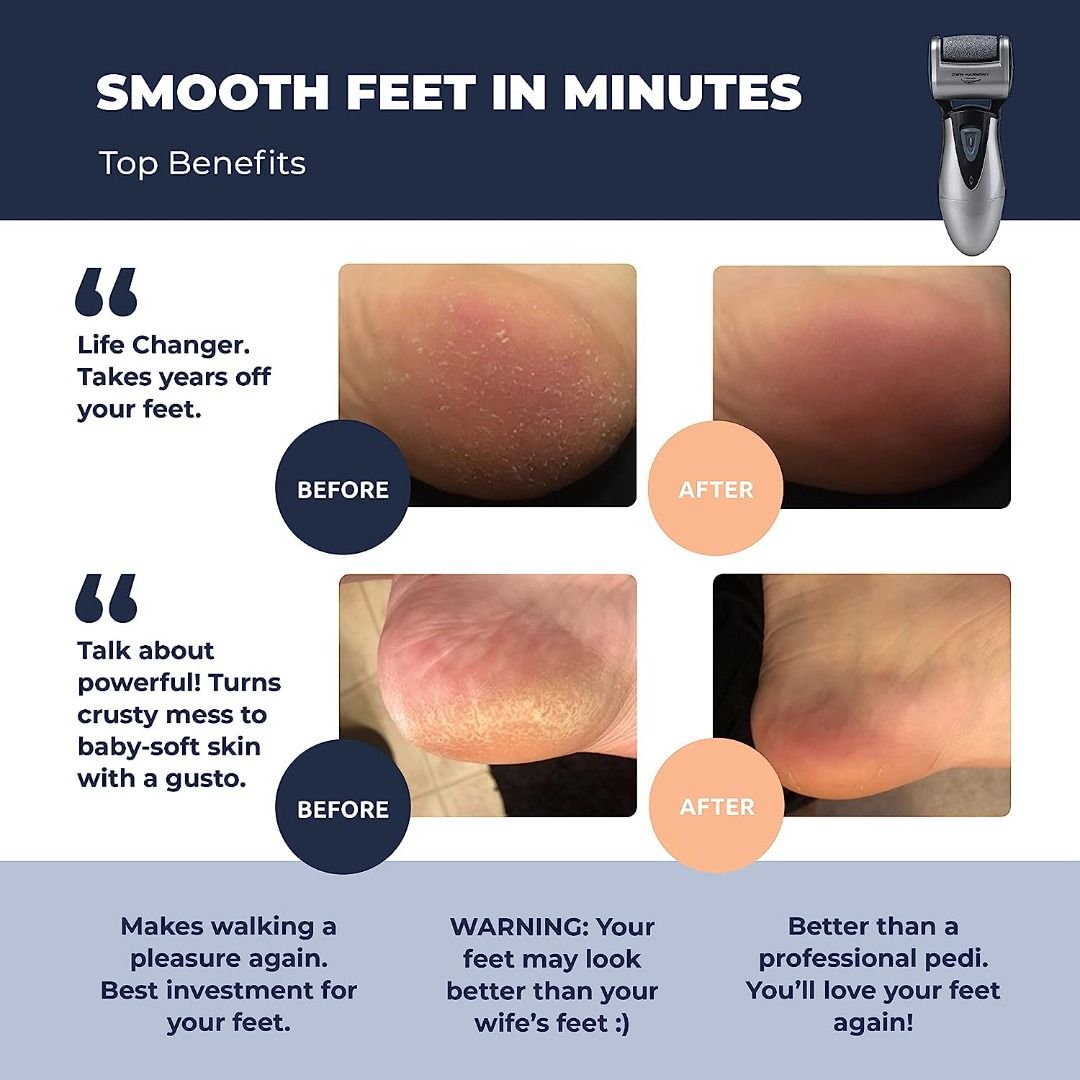 RIM Pumice Stone Cracked Heel Scrubber Callus Remover Foot Scrubber Thick  Skin Remover 