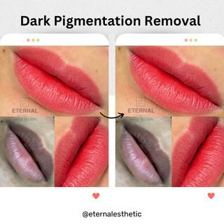 (Category: ) located in . Submitted by eternaletheticsg (Listing ID 1032303213, Image 1). Description: .