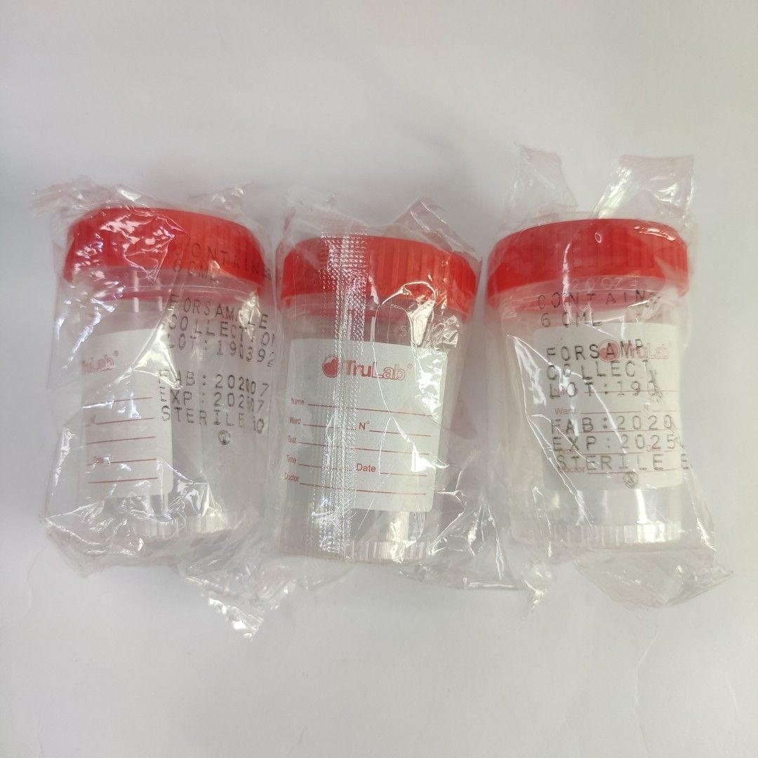 Urine Specimen Cup Container (Category: Medical Supplies & Tools) located in San Juan City. Submitted by paddybear (Listing ID 1243795290, Image 1). Description: P20.00 per pc.
