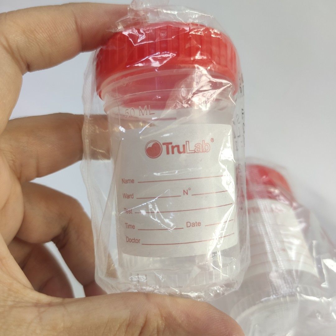 Urine Specimen Cup Container (Category: Medical Supplies & Tools) located in San Juan City. Submitted by paddybear (Listing ID 1243795290, Image 2). Description: P20.00 per pc.