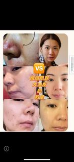 (Category: ) located in . Submitted by facialcaruseller (Listing ID 1244133162, Image 1). Description: .