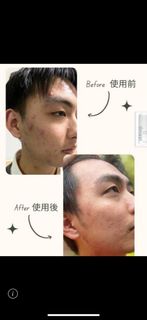 (Category: ) located in . Submitted by facialcaruseller (Listing ID 1244132769, Image 1). Description: .