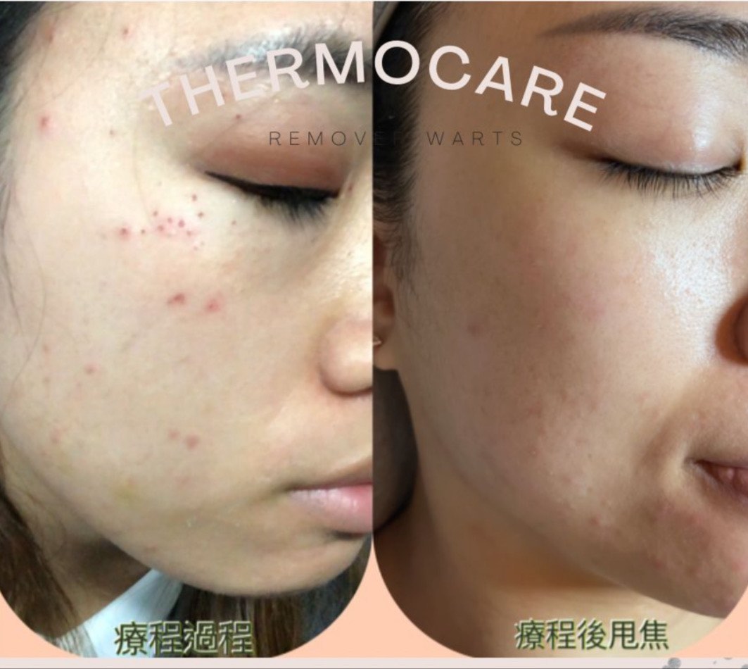 （分類：）位於 。 由 vbeautyplus 提交（商品編號 1176253818，圖片 1）。簡介： 。