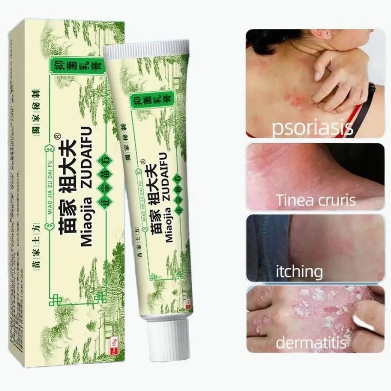15g Zudaifu Chinese Herbal Skin Psoriasis Cream Dermatitis Eczematoid ...