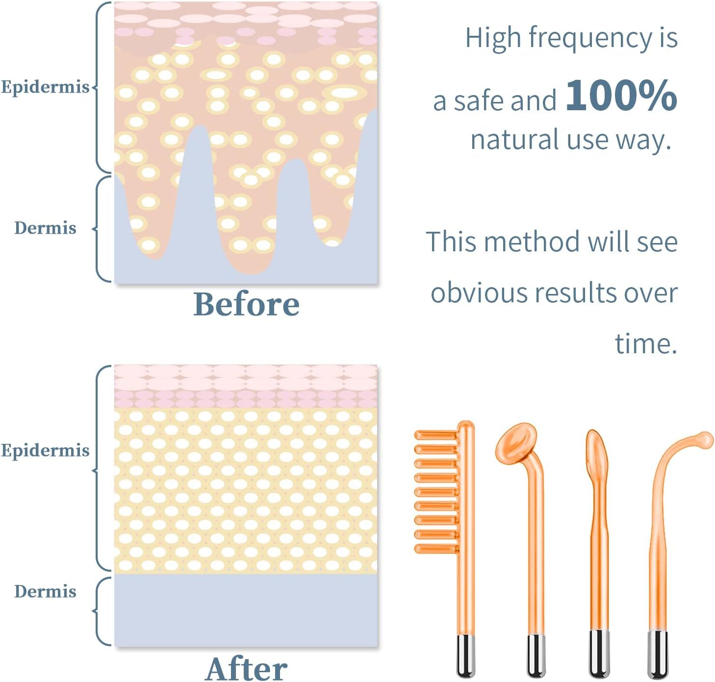 High Frequency Facial Machine - TUMAKOU Portable Handheld High ...