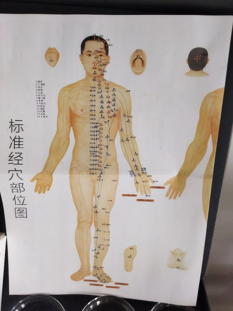 TCM Cupping Vacuum Therapy, Health & Nutrition, Assistive