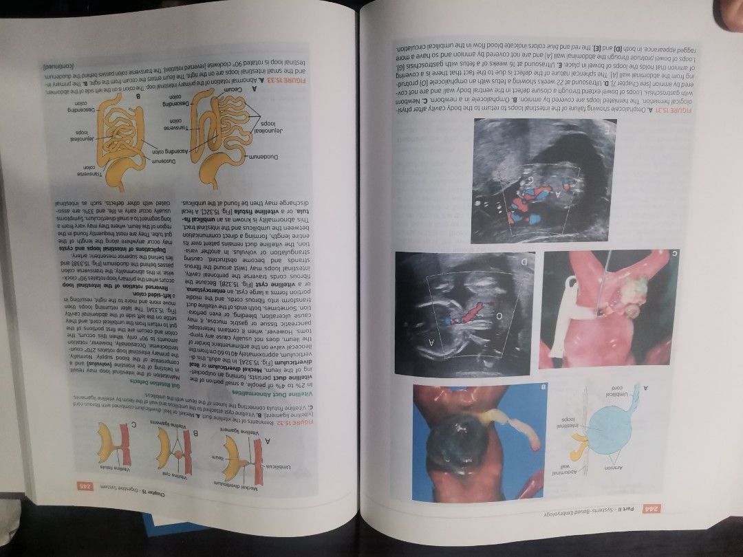 Langmann's Medical Embryology (Category: Textbooks) located in Valenzuela. Submitted by cesellsout (Listing ID 1248522529, Image 3). Description: 📣 For Sale: Langmann's Medical Embryology Reprint po ito pdf Mura na po ito compare magpaprint na colored 2pesos/page then ipa bookbind RFS: emptying shelf po with few higlights as posted shipping via J&T, lalamove muna po MOP: Gcash, cash, bdo/bpi Please feel free to chat for more info. Salamat po 😃.