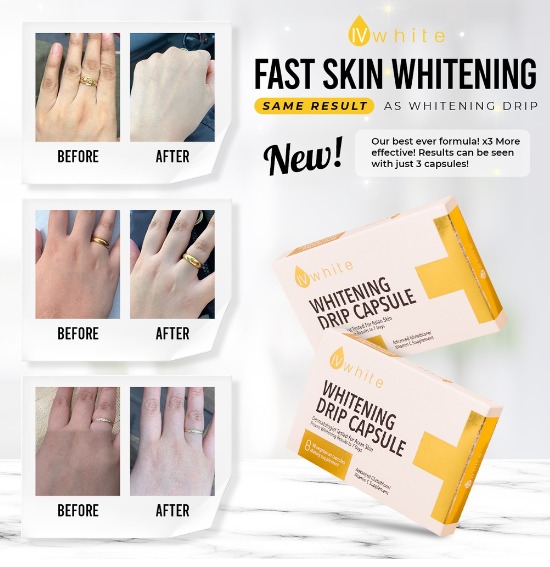 IvWhite KOREA Whitening Drip Capsule Supplement (HIGHLY EFFECTIVE