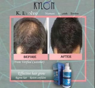Hair growth serum, anti hair loss, lasting permanent