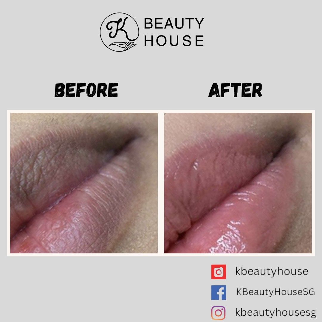 Lip Embroidery lip correction, Beauty & Personal Care, Face, Makeup on