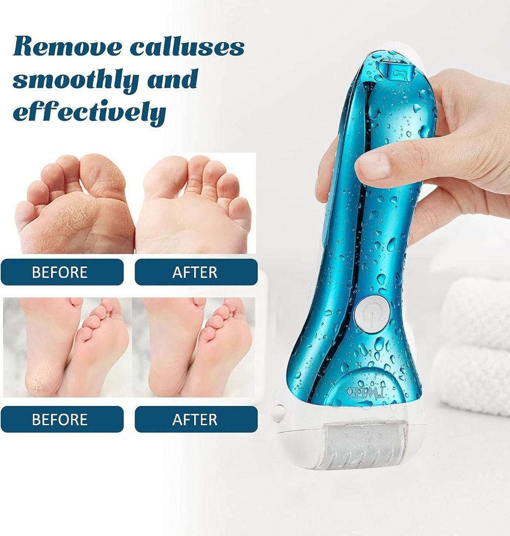 1pc Battery Operated Electric Foot File Dead Skin Remover Callus Remover  Foot Scrubber For Baby Soft Feet