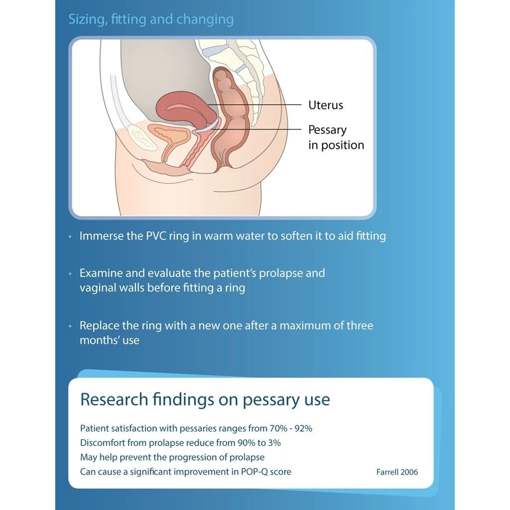 Vaginal Pessary: Causes, Symptoms, Treatment and Cost