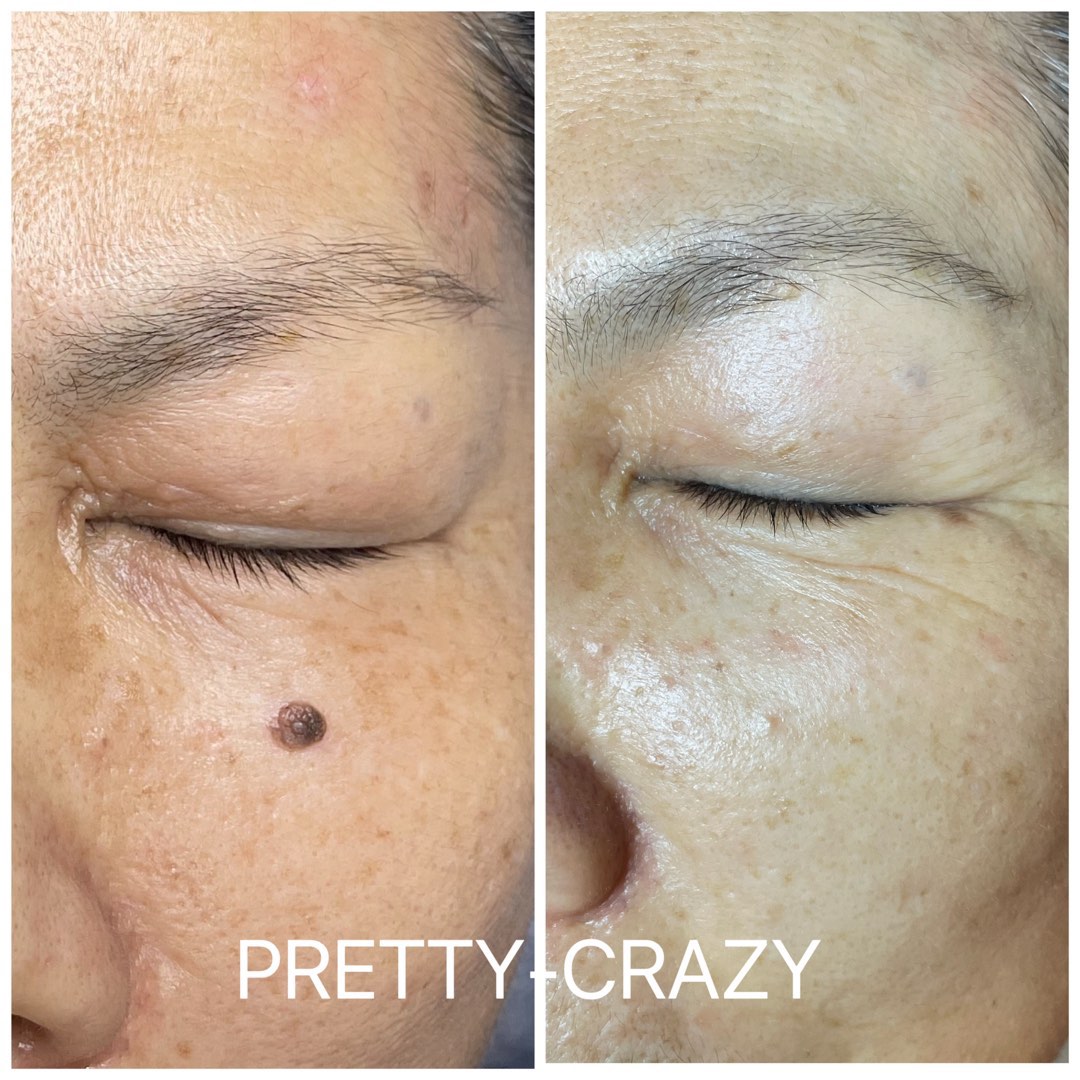 （分類：）位於 。 由 prettycrazybeauty 提交（商品編號 1227266636，圖片 1）。簡介： 。