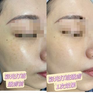 （分類：）位於 。 由 kat2020 提交（商品編號 1251218807，圖片 1）。簡介： 。
