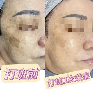 （分類：）位於 。 由 kat2020 提交（商品編號 1227765659，圖片 1）。簡介： 。