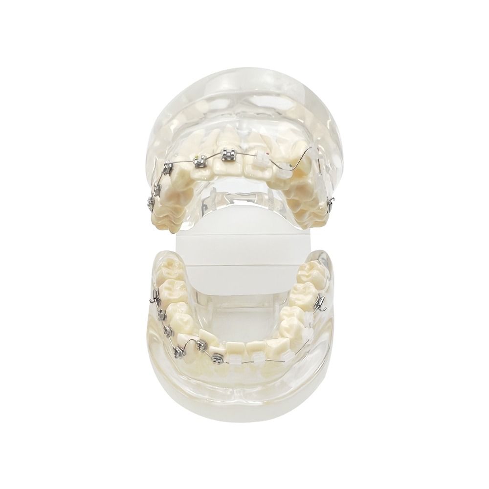 Dental Transparent Teaching Model Orthodontic Teeth Model With Metal ...