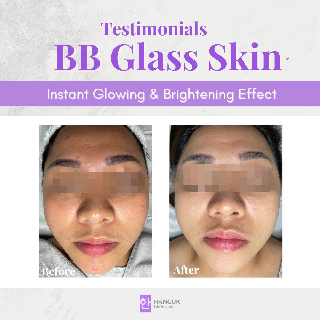 Korean BB Glass Skin (2 Sessions) Instant BB Glow Results Facial