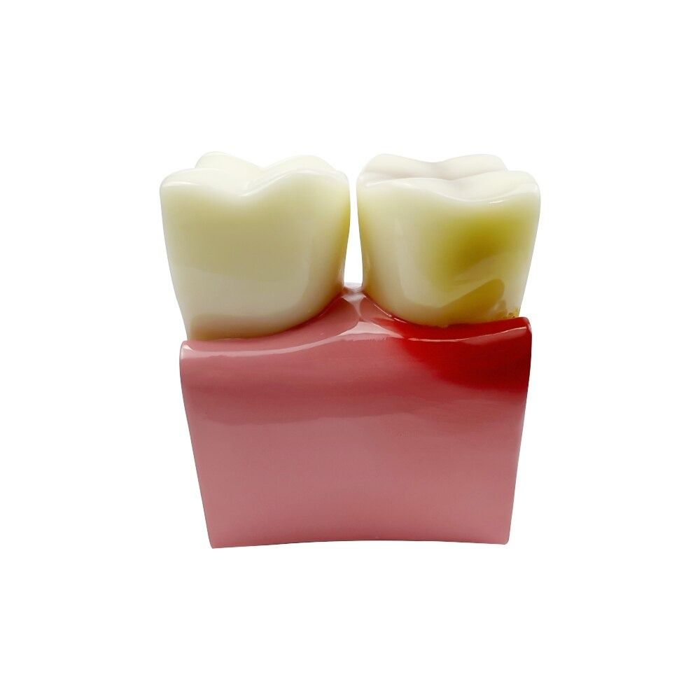 Big Dental Teeth Model Anatomy Large Dental Anatomical Model For ...