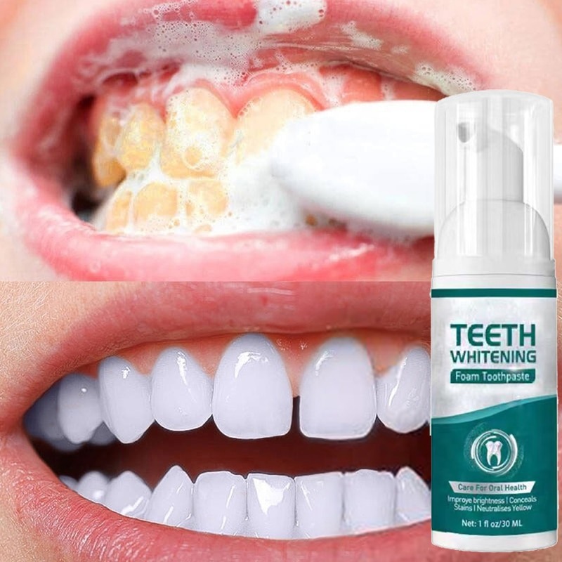 Teeth Whitening Mousse Dental Care Essence Remove Plaque Tooth Stain Gingival Repair Caries