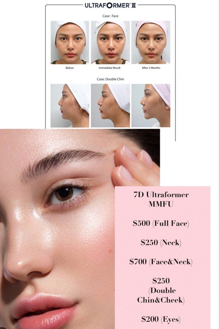 Latest non invasive jawline sharpening, face lifting , rejuvenation