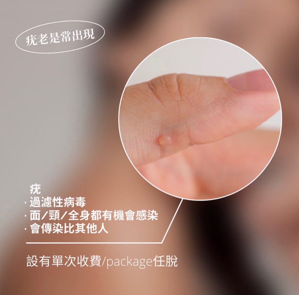 （分類：）位於 。 由 zero.brows 提交（商品編號 1253000503，圖片 1）。簡介： 。
