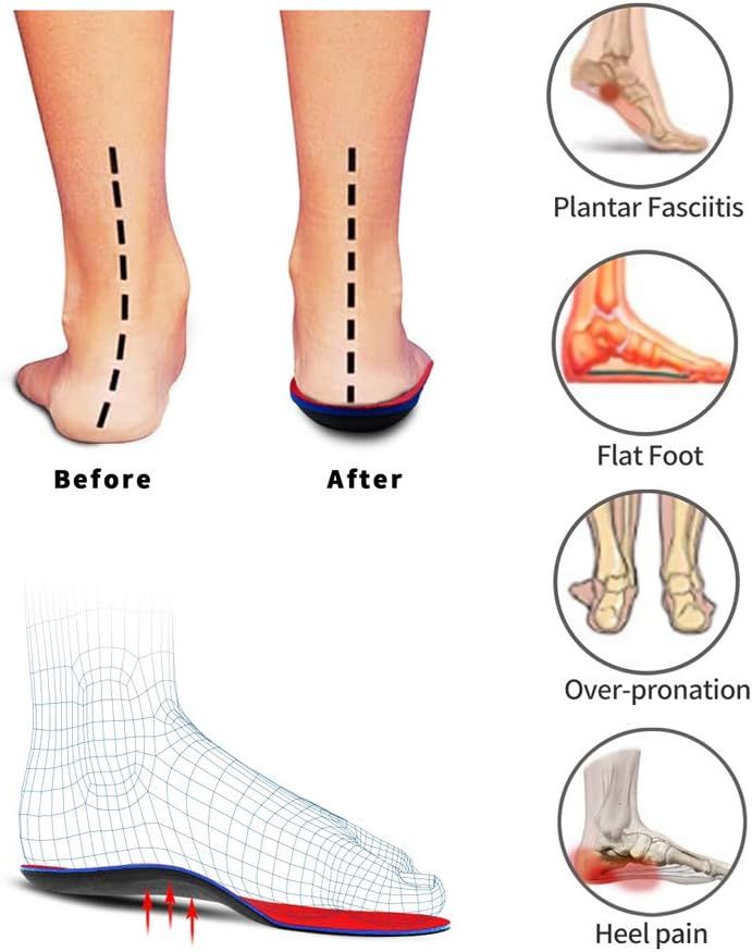 Mens insoles discount for plantar fasciitis