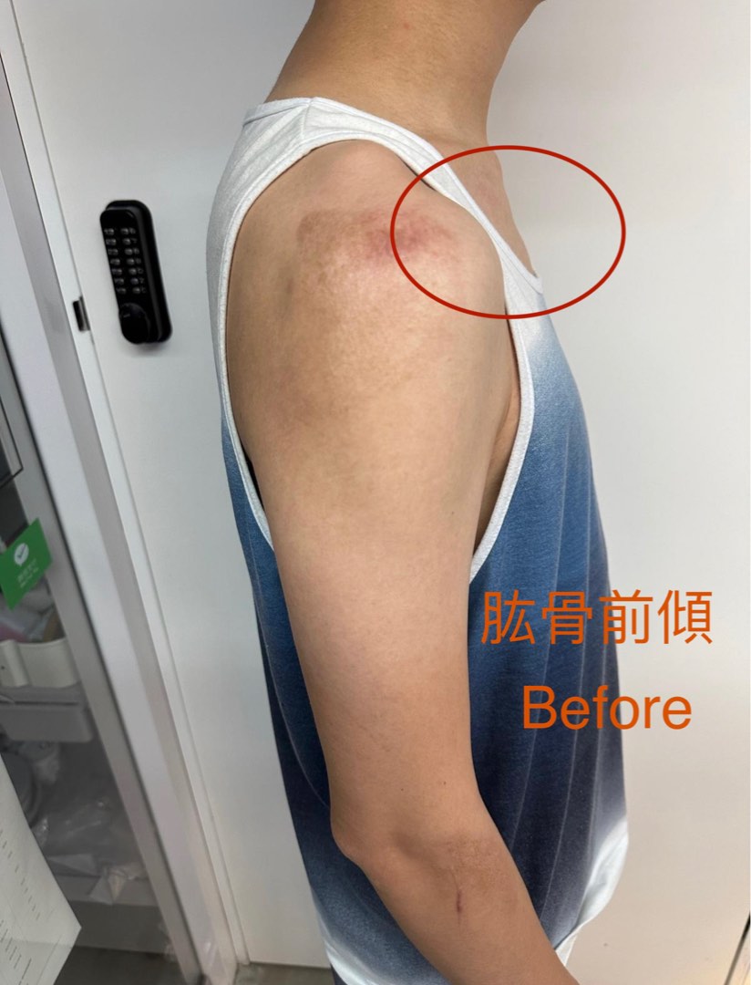 💁🏻‍♂️🤗痛症治療&整體筋膜放鬆&改善O型腳及嚴重，扁平足，高低腳62859980756739111